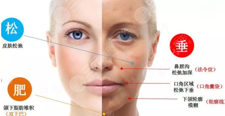 射频除皱多久能看到果