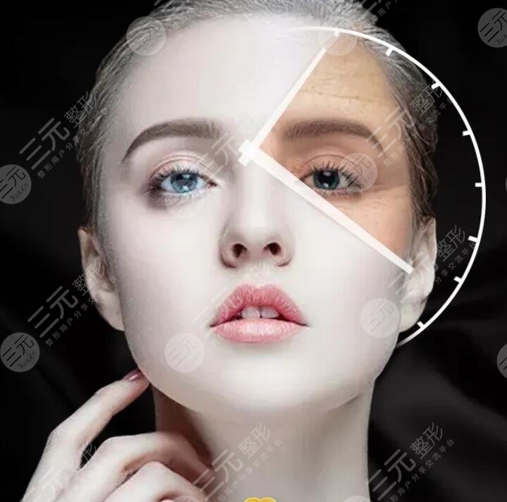 射频除皱的注意事项