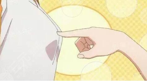 [案例]协和医院曾昂丰胸 自体脂肪隆胸后软得像棉花糖！