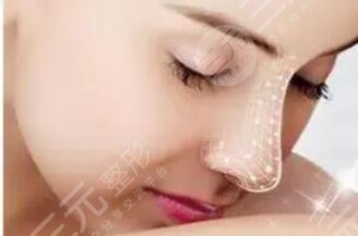 隆鼻整形