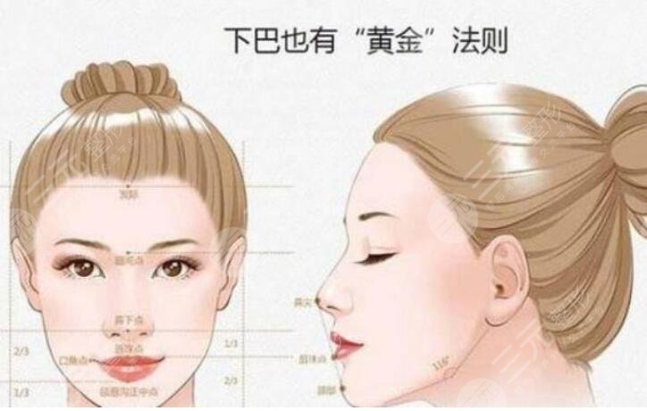 下巴截骨术后护理知识
