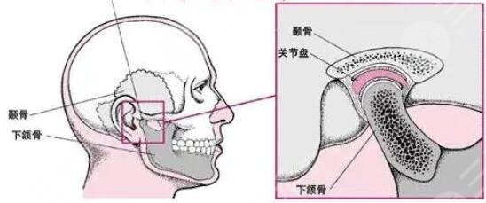 下巴截骨术的优势