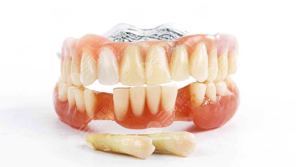 种植牙全口牙需较少种多少颗