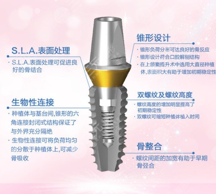 登腾种植牙后期稳定性怎么样
