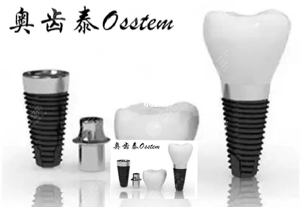韩国种植牙登腾和奥齿泰哪个好