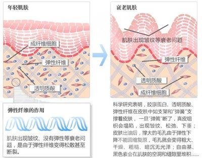 面部除皱有方法