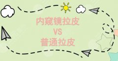 内窥镜拉皮和普通拉皮的区别|适应症_创伤_果等4个方面深层盘点! 内窥镜拉皮和普通拉皮的区别|适应症_创伤_果等4个方面深层盘点!