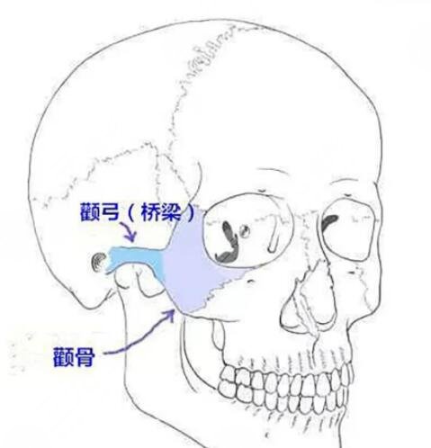 颧骨降低手术之后应该怎样去做