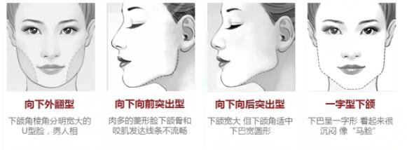 磨骨手术的原理