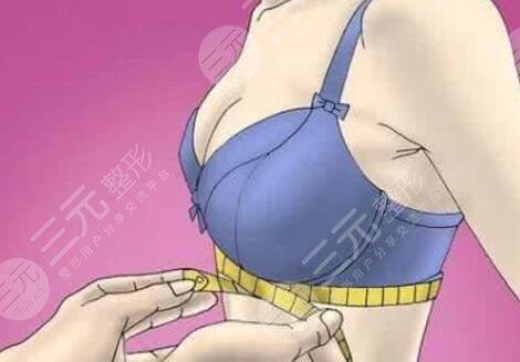 隆胸假体