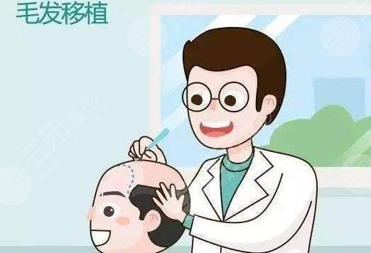 植发医疗项目科普之头发种植手术问答