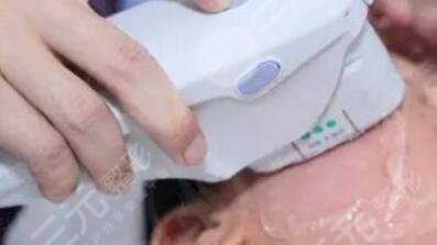 抗衰超声炮