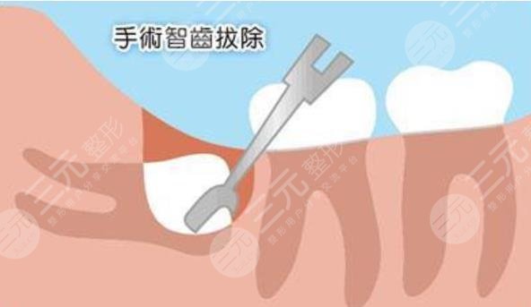 烤瓷牙的价格探秘：性价比的选择