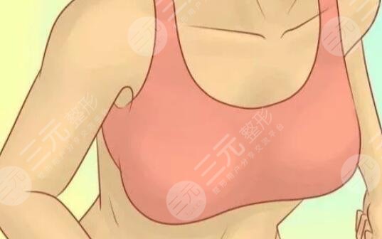 隆胸