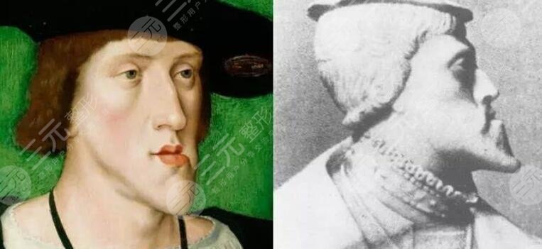 改脸型手术痛吗