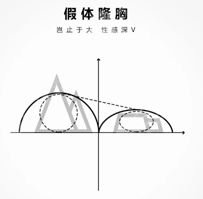 法国伊思雅假体好不好