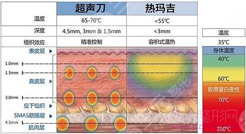 超声抗衰仪器