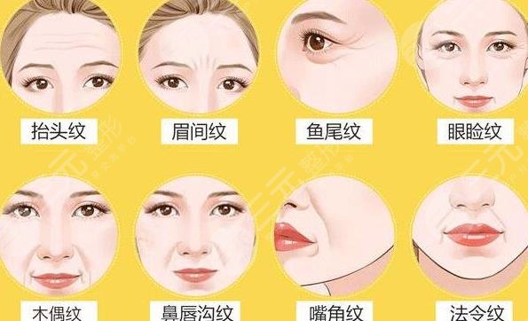 生物注射杆菌除皱
