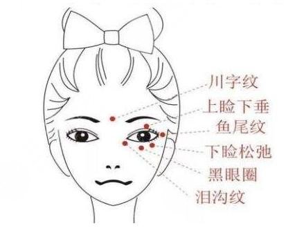 什么是鱼尾纹