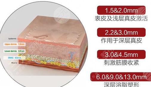 聚拉提手术的果