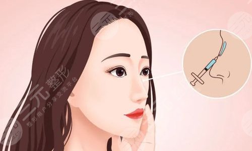 胶原蛋白隆鼻维持多久？和玻尿酸隆鼻哪个好？有风险吗？【美鼻攻略】