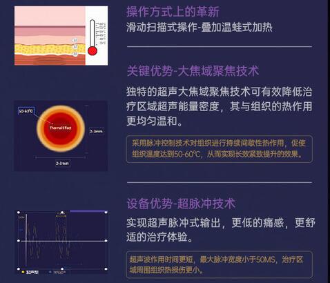 超声炮