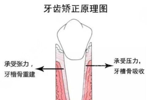 大连市口腔医院科普牙齿矫正原理