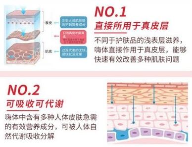嗨体去颈纹