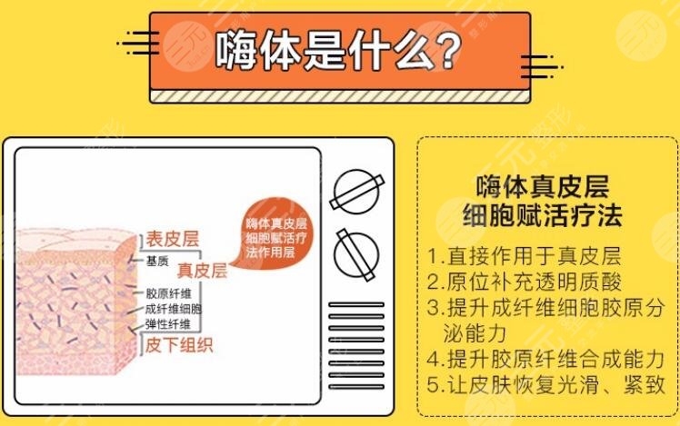 嗨体