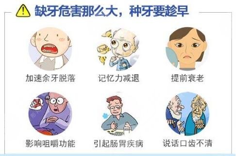 种植牙科普