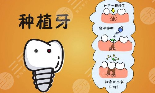 国内种植牙品牌有哪些？种植牙的过程居然是这样的，看完备受震撼！