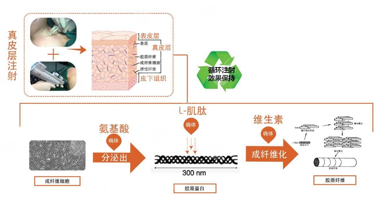 嗨体填充泪沟多久能见?
