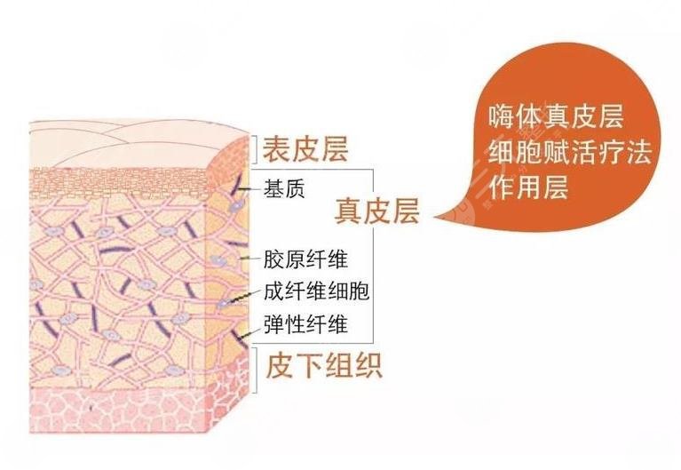 嗨体填充泪沟有没有副作用?