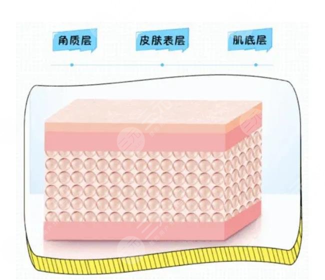 嗨体除皱相关知识科普