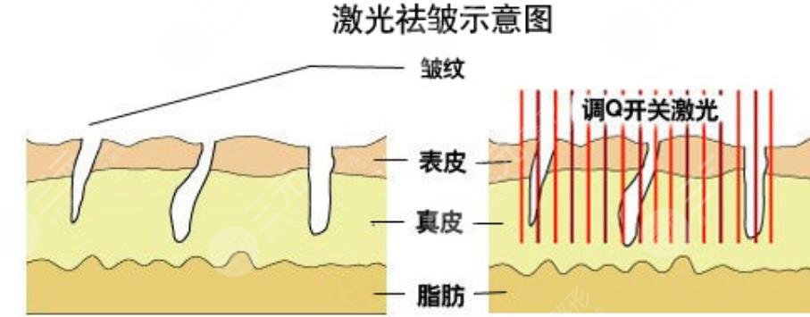 防晒修护
