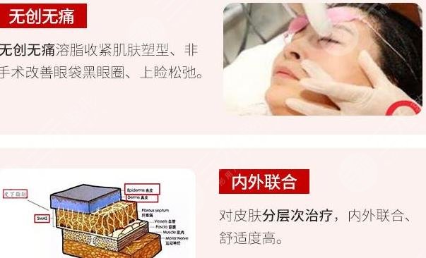 快速收紧模式