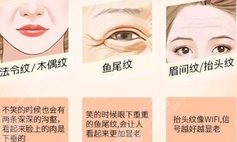玻尿酸除皱