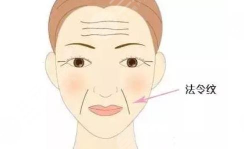电波拉皮手术