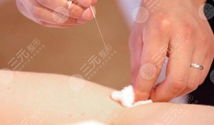 中医中医减肥
