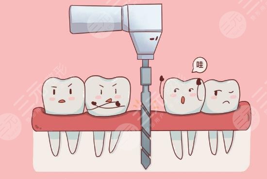 种植牙的危害有哪些
