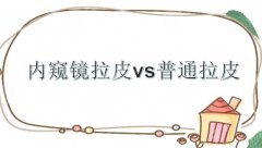 内窥镜拉皮和普通拉皮的区别|适应人群_切口大小_维持时间等盘点! 内窥镜拉皮和普通拉皮的区别|适应人群_切口大小_维持时间等盘点!