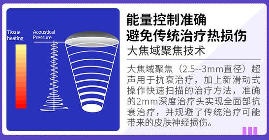 超声炮