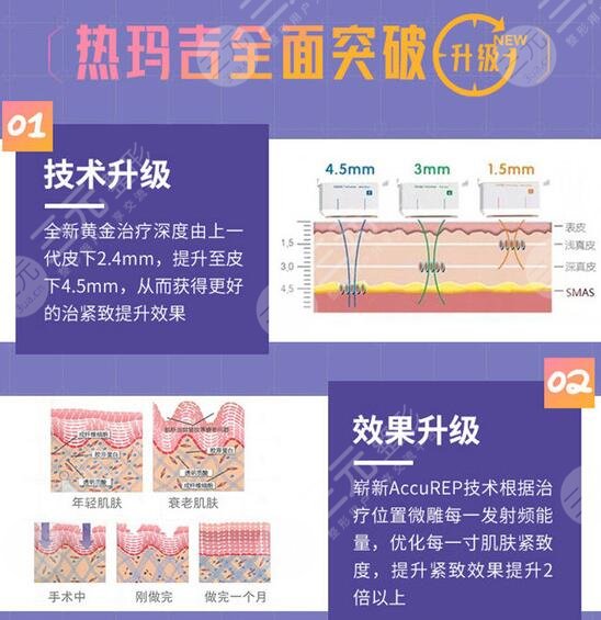 热玛吉flx5代价格多少钱？2021参考价+术后事项全新指南来咯！