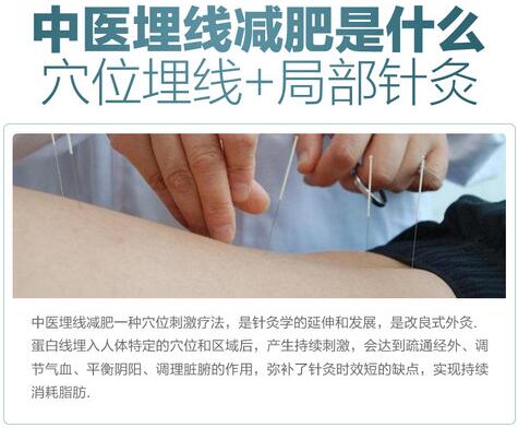 中医中医减肥果怎么样，多少钱一次？原理科普+价格，瘦身秘籍搞定！
