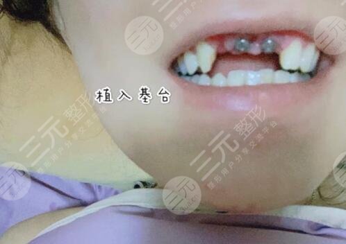 个人口腔状况