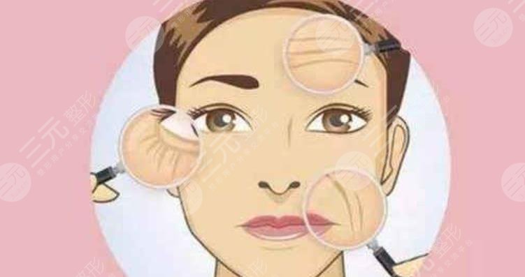 B****除皱能维持多久