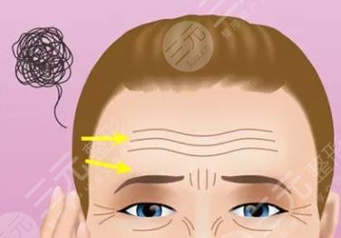 B****除皱的副作用大吗？具体有哪些？本文就好好的扒一扒~