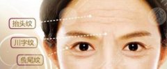 脂肪填充除皱果好不好?什么原因影响了果维持时间?小白必看! 脂肪填充除皱果好不好?什么原因影响了果维持时间?小白必看!