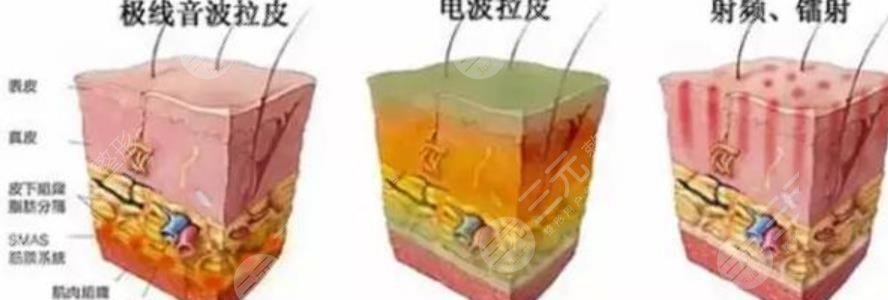抗衰