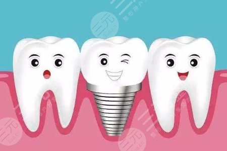 种植牙的成好吗